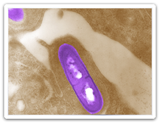 Listeriosis (Listeria monocytogenes)