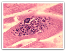 Toxoplasmosis (Toxoplasma gondii)